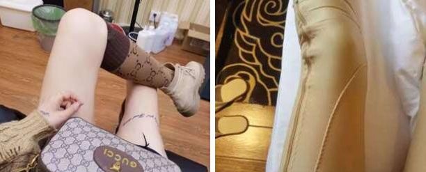 武汉壹加壹医疗美容医院李艳东主任给我做水动力大腿吸脂术后2个月恢复过程图 图2