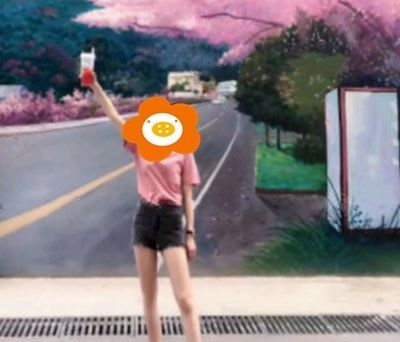 到泉州做大腿吸脂满三个月，今天来聊聊我的心路历程 案例图2