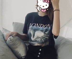 120斤的我选择大腿吸脂手术就是为了走路不再磨腿 图2