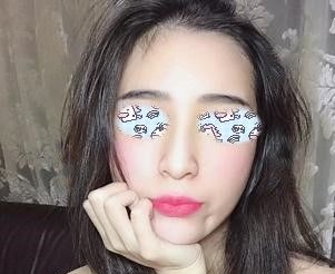 真人记录:做艳冠硅胶垫下巴65天后用手托腮so easy 图2