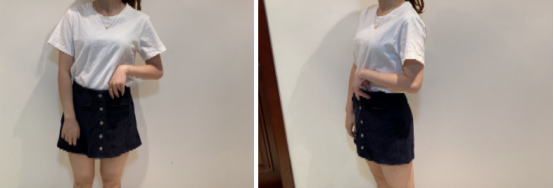 西安高一生做全身吸脂手术挺好的,公布西安高一生做吸脂的实例