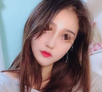 西安画美整形医院做假体隆鼻手术真的厉害,看我恢复以后的照片就知道了 图2