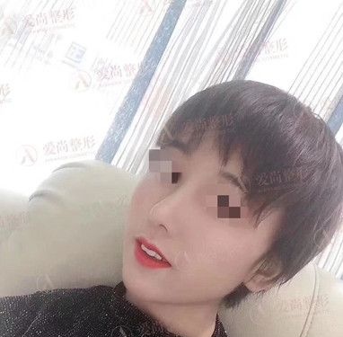 是时候公开歪鼻梁的我在洛阳爱尚做的鼻综合整形手术全过程了 图2