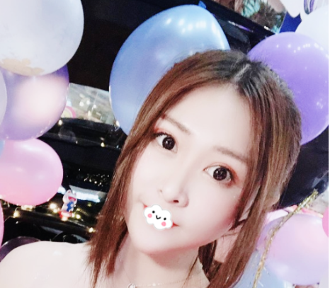 今天得空给大家看下我花6800多元找广州曙光张小芸做的三分钟去眼袋效果有多好 图2