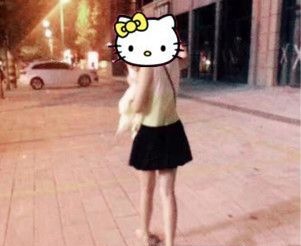 大腿环吸后晚上真的超级疼,但看到效果后说句实话不后悔 图2