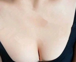 @所有人:想知道麦格假体270cc隆胸后是多大罩杯,就往这看 图2