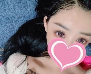 用真人真事告诉你脂肪填充太阳穴术后为什么不能大笑 图2