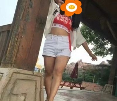 做大腿吸脂手术3个月了!今天来嘚瑟一下我的大长腿