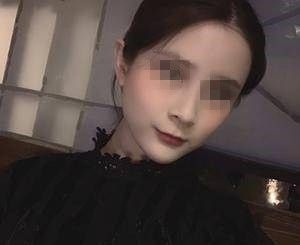 想改善面颊凹陷和泪沟做一次脂肪填充全脸手术就轻松搞定了 案例图2