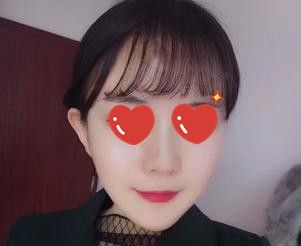 本来就是圆脸还被医生推荐做脂肪填充,想知道到底是什么鬼花1分钟看完这篇文章就了解了 图2