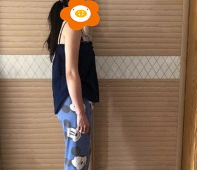 假体隆胸300cc术后真实案例分享:自从胸部有料后我要大大方方地抬胸做女人了