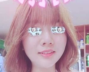 埋线提升做完脸紧绷了2个月,到医院咨询后才知道只属于正常现象不用担心 图2